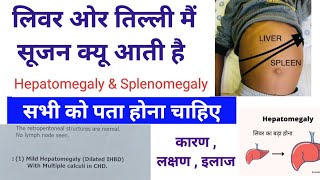 Liver ओर Spleen तिल्ली में सूजन क्यों आती है  Hepatomegaly amp Splenomegaly Causes  symptoms [upl. by Angadresma]