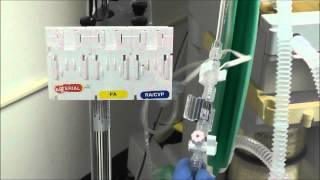 How to Setup an Arterial Line Transducer [upl. by Yggam]