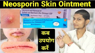 Neomycin and polymyxin b sulfates and bacitracin zinc ointment usp in hindi  neosporin ointment [upl. by Godwin]