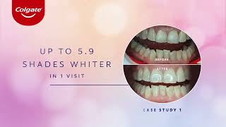 Colgate Optic White LightUp 10 InOffice Whitening Kit [upl. by Sutton]