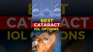 Best Cataract IOL Options [upl. by Erica666]