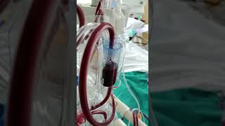 CRRT Continuous Renal Replacement Therapy [upl. by Rasure]