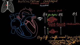 Auscultation cardiaque  Souffles cardiaquesbruits surajoutésExercices  Partie 2 Docteur Synapse [upl. by Adnilav703]