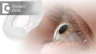 Can patients without Cataract have multifocal lens implants  Dr Sriram Ramalingam [upl. by Laureen]