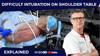 Difficult Intubation on a Shoulder Surgery Table  Crash course with Dr Hadzic [upl. by Namreg928]