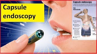 Capsule endoscopy [upl. by Effy498]