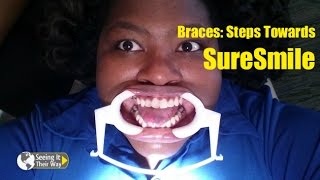 Braces Steps Towards SureSmile [upl. by Allista]