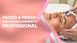 Como fazer Microagulhamento Profissional [upl. by Nogras]