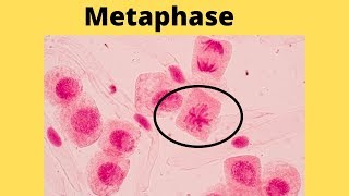 What happens during metaphase [upl. by Eberle]