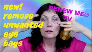 Remove Eye Bags  Under Eye Fluid  Festoons  Malar Bags Using Easy Exercise for Face  FACEROBICS® [upl. by Erroll]