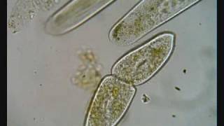 Paramecium Dividing [upl. by Immat]