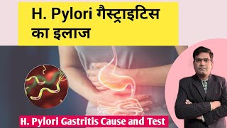 HPylori Gastritis Cause Symptoms and Treatment Explained in Hindi [upl. by Ibbed]