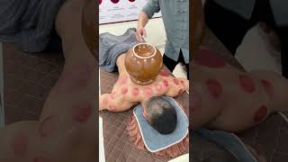 You should not inhale when opening a cupping cups asmr cuppingtherapy youtubeshorts relax china [upl. by Ssac425]