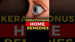 Home Remedies For Keratoconus [upl. by Ameehsat94]