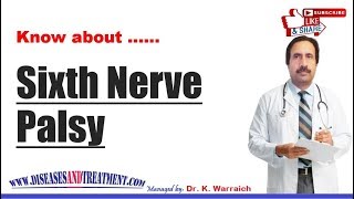 Sixth Nerve Palsy  Causes Diagnosis Symptoms Treatment Prognosis [upl. by Teressa]