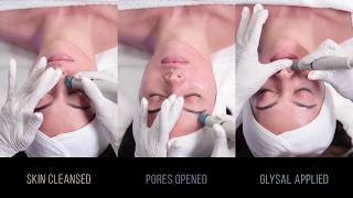 HydraFacial Signature behandeling  TRAINING [upl. by Gough912]