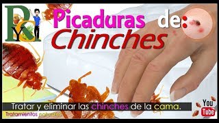 🕷️🐛 Picaduras de chinches  Piquetes de chinches  Como eliminar chinches de la cama picaduras 🛏️ [upl. by Carmine]