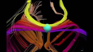 A panmammalian map of interhemispheric brain connections predates the evolution of the corpus [upl. by Aihseyk]