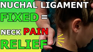 Nuchal Ligament FIXED  Neck Pain RELIEF [upl. by Greenes882]