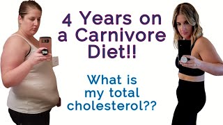 4 Year Carnivore What is my Total Cholesterol Full breakdown of my lipid panel on a Carnivore Diet [upl. by Avitzur]