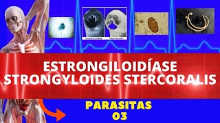 ESTRONGILOIDÍASE  STRONGYLOIDES STERCORALIS VERMINOSE  PARASITOLOGIA  INFECTOLOGIA [upl. by Dahij401]