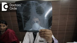 Is Tuberculosis contagious how does it spread  Dr Hirennappa B Udnur [upl. by Airol]