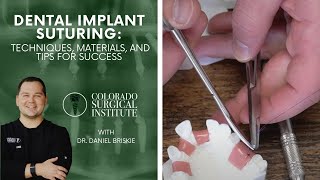 Dental Implant Suturing Techniques Materials and Tips for Success [upl. by Nob589]