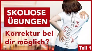 Effektive Skoliose Übungen für dein Training  Gegen Beschwerden  Fit amp Schmerzfrei [upl. by Anilys]