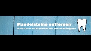 Mandelsteine entfernen  so einfach gehts [upl. by Nayek119]