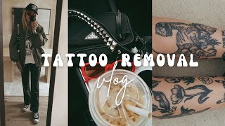 GETTING MY TATTOOS REMOVED  Tattoo Removal Laser Vlog [upl. by Bullock]