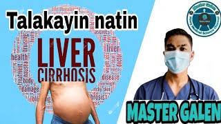 Liver Cirrhosis talakayin natin [upl. by Tatum]