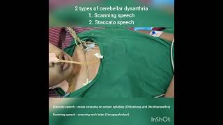 Cerebellar dysarthria  Scanning speech and Staccato speech  DrKamaleshTNMediCalLectures [upl. by Larisa]