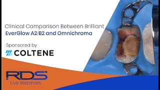 Clinical comparison between Brilliant EverGlow A2B2 and Omnichroma [upl. by Sylera]