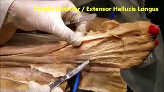 FOOT DORSUM Tendons Muscles Neurovascular and Clinical Correlations – Sanjoy Sanyal [upl. by Arretak697]