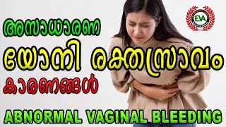 ABNORMAL VAGINAL BLEEDING I അസാധാരണ യോനി രക്തസ്രാവം Iഗർഭാശയ രക്തസ്രാവം I UTERINE BLEEDING I കാരണങ്ങൾ [upl. by Itram]