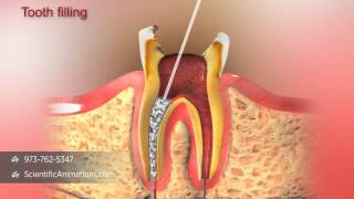 Introduction to the pulp cavity [upl. by Anippesuig193]