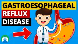 Gastroesophageal Reflux Disease GERD Explained [upl. by Sawyor]