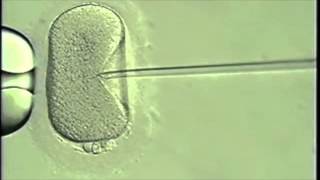 Overcoming Infertility  Intracytoplasmic Sperm Injection Pioneered by UCSF [upl. by Anirehtak]