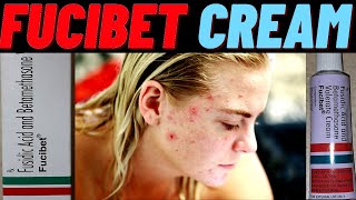 fucibet cream use in hindi how to use fucibet cream side amp effects and benefits [upl. by Winnick274]