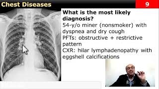 Chest case Diagnose it internalmedicine cme usmle محاضراتباطنة ecg clinical [upl. by Etteyniv]