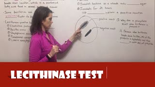 Lecithinase Test [upl. by Sabian351]