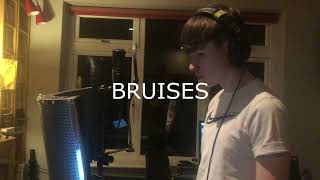 Bruises  Lewis Capaldi Cathal Mulvey Cover [upl. by Shornick]