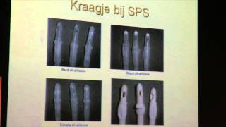 Congres Urologie  20 april 2015  Dhr Cel Vandewinkel  deel 2 [upl. by Thgiled501]