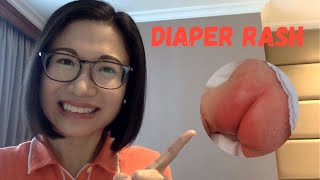 Diaper Rash How to treat it at Home and When to Worry and Call Your Doctor  Dr Kristine Kiat [upl. by Norreht]