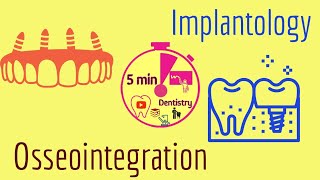 Osseointegration  Implantology  easy  lecture  5 min Dentistry [upl. by Marita570]