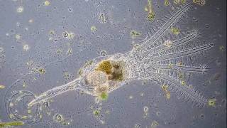 Stephanoceros fimbriatus  the most beautiful rotifer [upl. by Gwenora361]