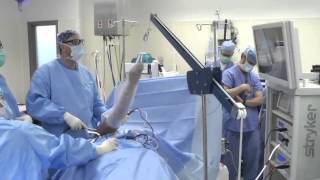 Shoulder Arthroscopy Surgery [upl. by Myles]