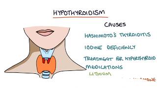 Hypothyroidism and Hashimotos Thyroiditis Visual Explanation for Students [upl. by Nagey626]