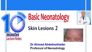 Neonatal skin Lesions 2 [upl. by Novert]