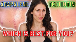 Adapalene vs Tretinoin  Which Is The Best ANTIACNE and ANTIAGING Ingredient [upl. by Ariom20]